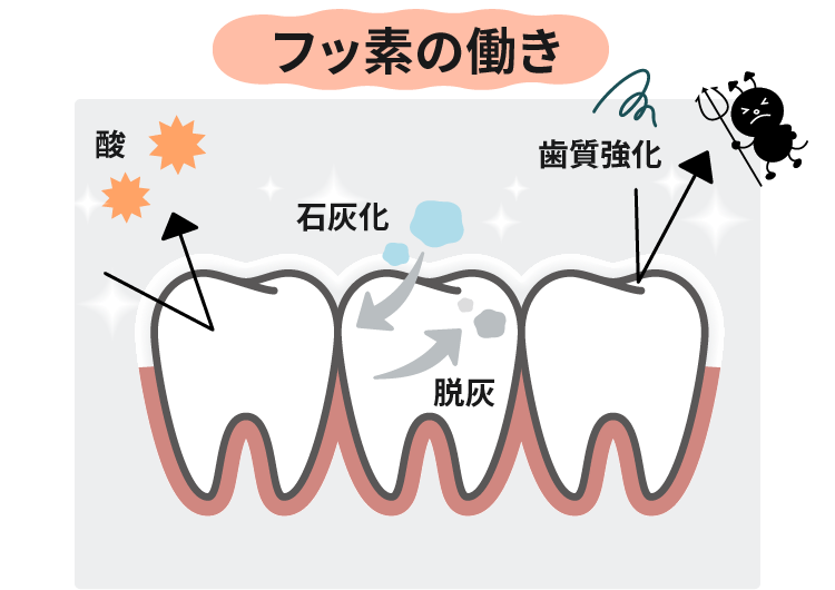 初期の虫歯治療フッ素