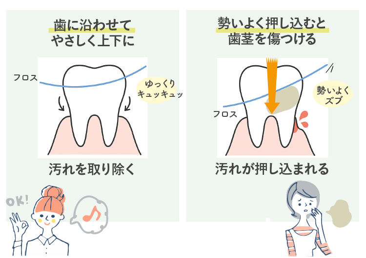 フロスの間違った使い方