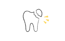 歯科のお悩み・歯が欠けた