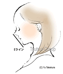 Eラインをつくる矯正