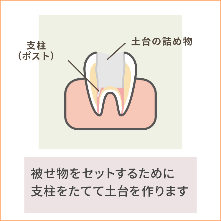 土台の構築