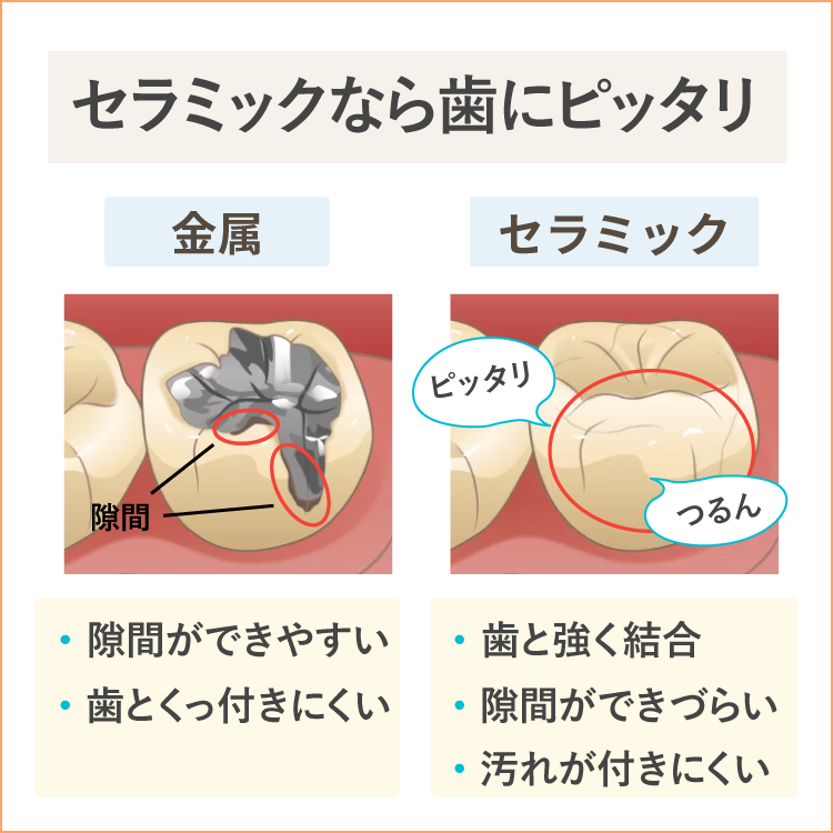 セラミックなら歯に結合