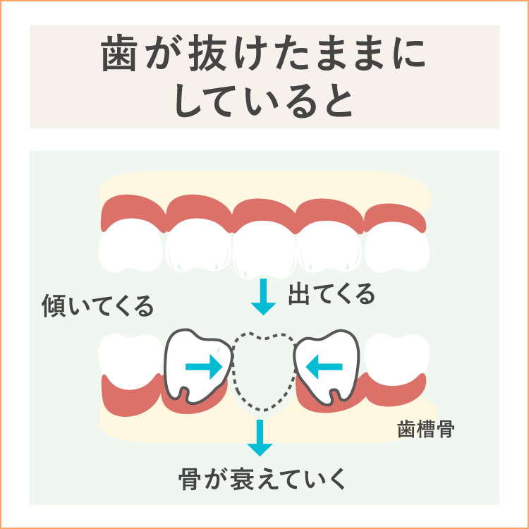 噛み合わせの不具合