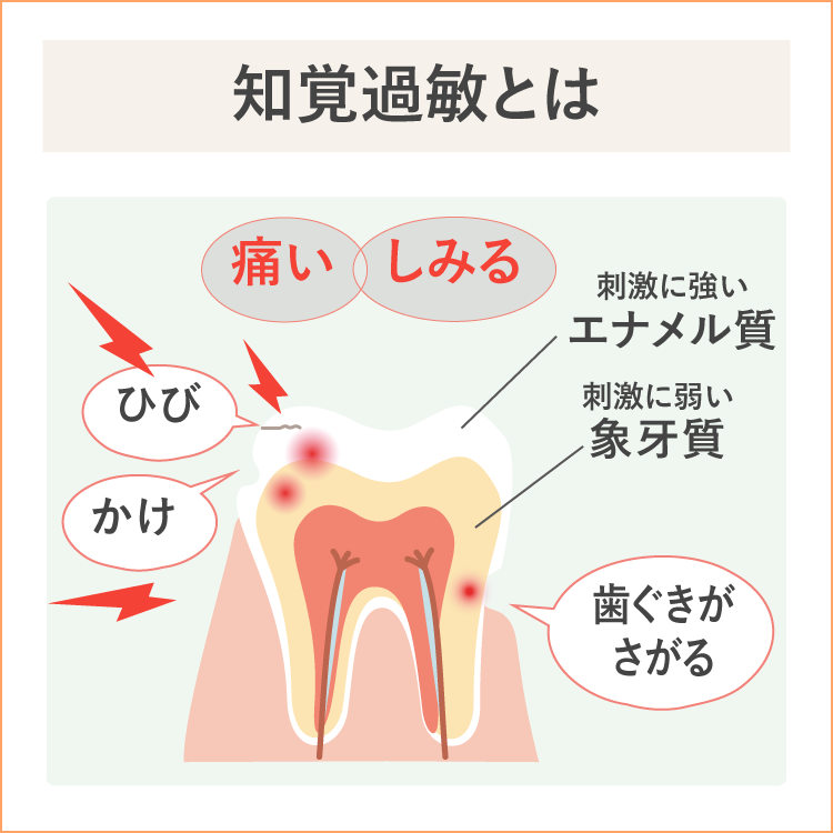 知覚過敏